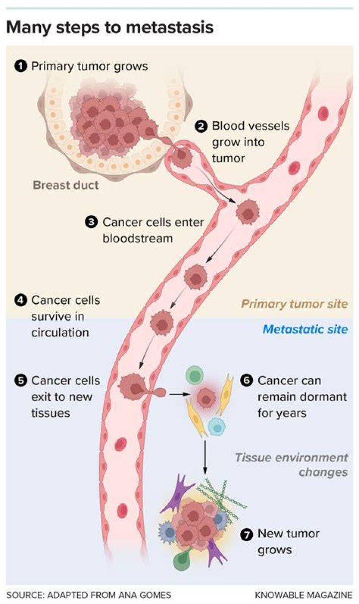 Can a small tumor metastasis?