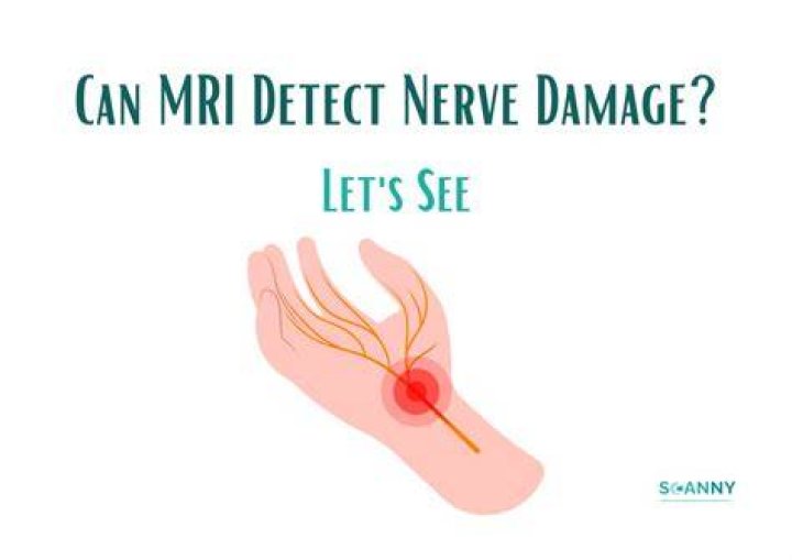 Can an EEG detect nerve damage?