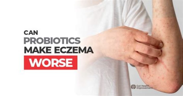 Can probiotics make eczema worse?
