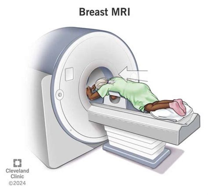 Can you lay on your stomach for an MRI?