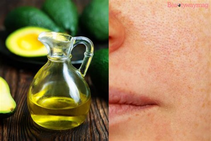 Does avocado oil clog your arteries?