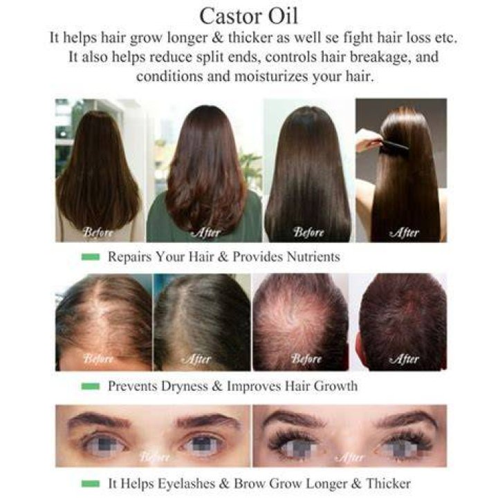 Does castor oil actually thicken hair?