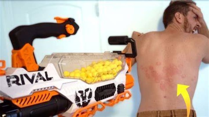 Does Nerf rival hurt?