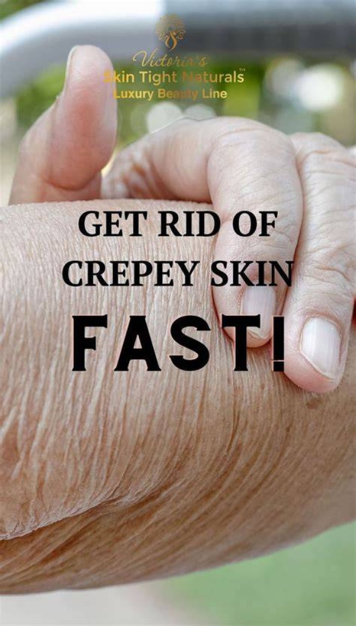 How do you stop Crepey arms?