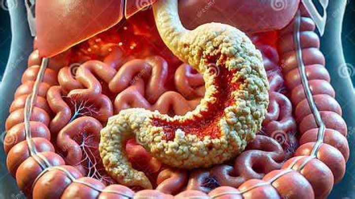 How do you tell if the lining of your stomach is damaged?