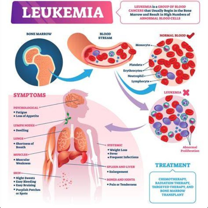 How long can you have leukemia for?