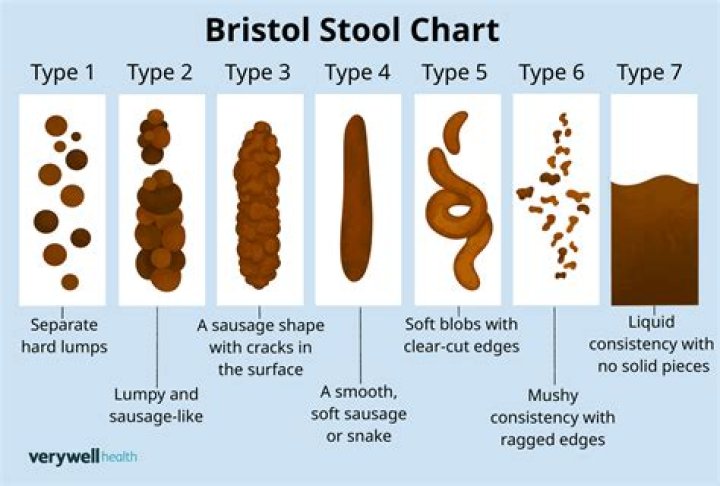 How long is too long to have loose stools?