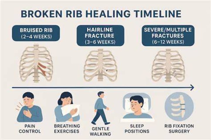 How long should I be off work with broken ribs?