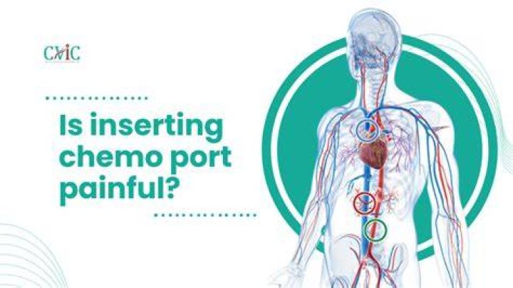 Is having a port put in painful?