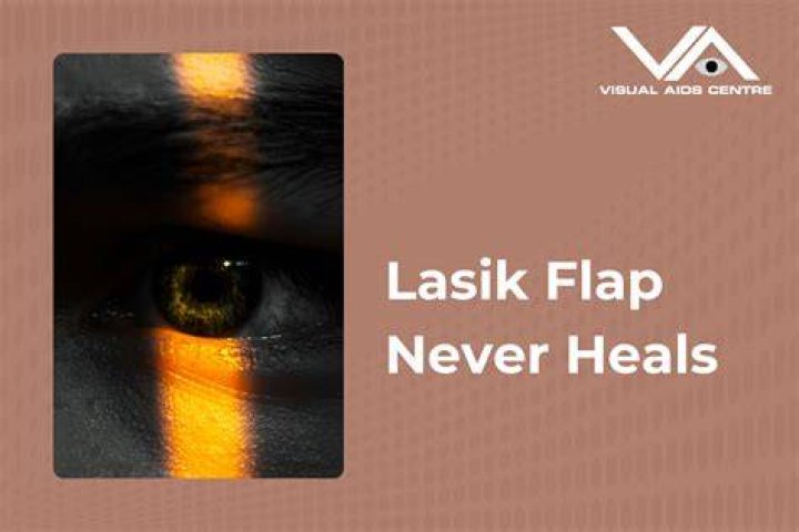 Is it true that LASIK flap never heals?