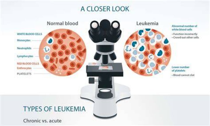 What does leukemia look like on a blood test?