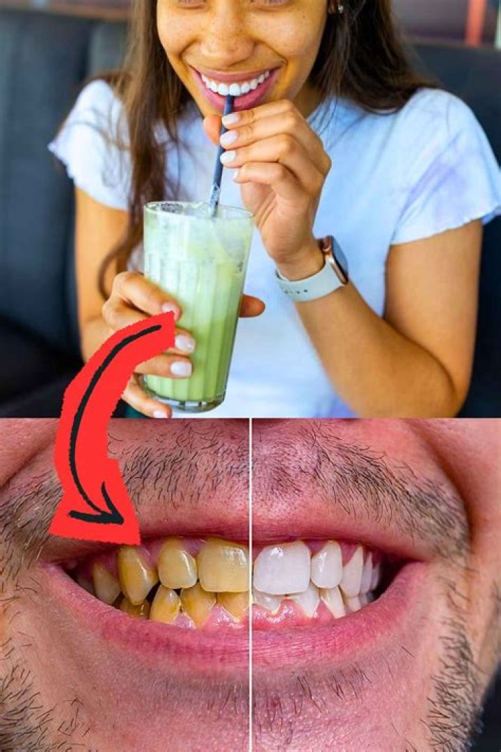 What drink does not stain teeth?