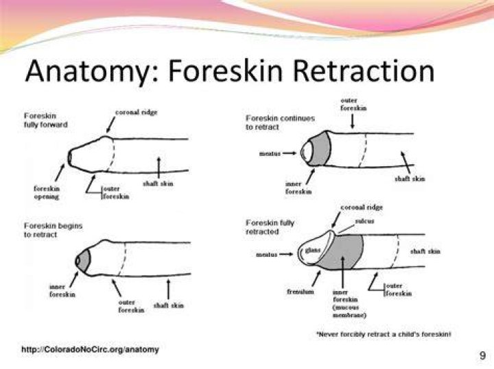 What is foreskin used for after circumcision?