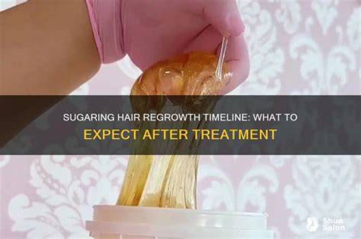 What to expect after sugaring?