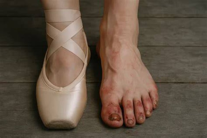 What would happen if ballerina dance without wearing proper shoes?