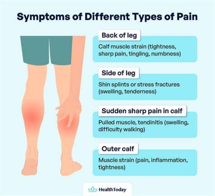 When is leg pain serious?