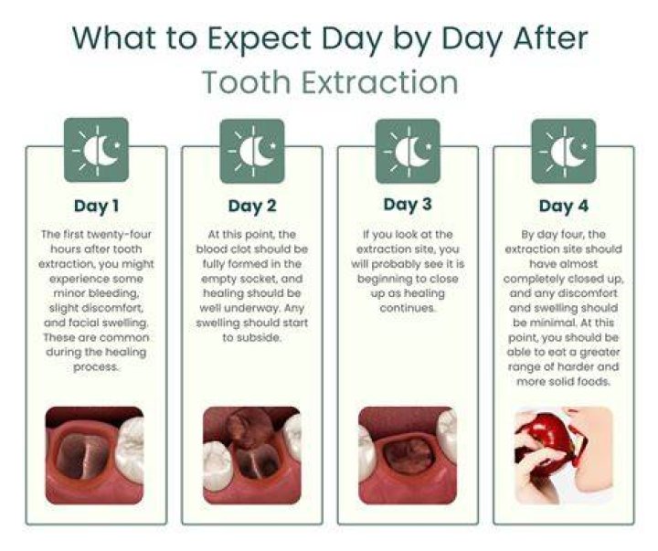 Which antibiotic is best after tooth extraction?
