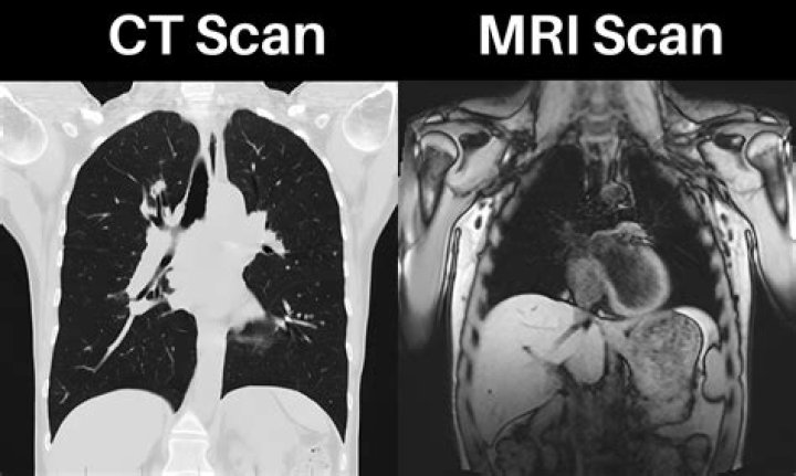 Which is better CT scan or MRI?