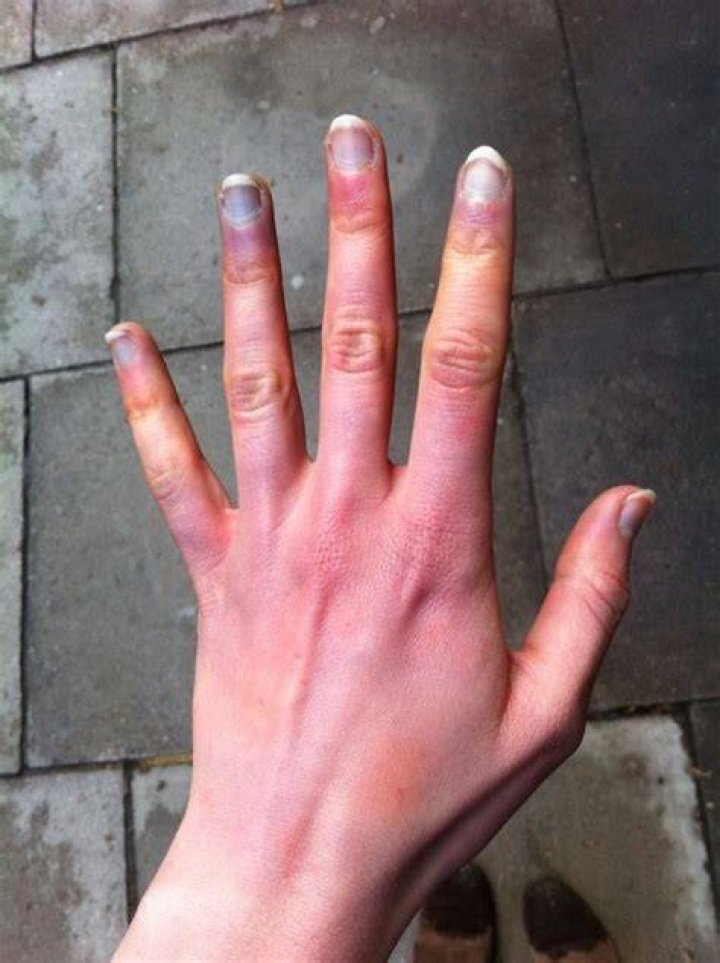 Why are my hands blue GREY?